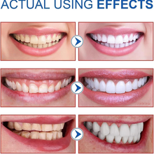 Load image into Gallery viewer, SP10 Probiotic Toothpaste