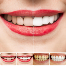 Load image into Gallery viewer, SP10 Probiotic Toothpaste