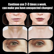 Load image into Gallery viewer, Portable Skin Therapy Machine with 6 Neon &amp; Argon Wands