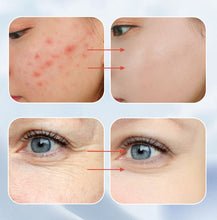 Load image into Gallery viewer, Portable Skin Therapy Machine with 6 Neon &amp; Argon Wands