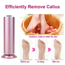 Load image into Gallery viewer, Electric Foot Callus Remover
