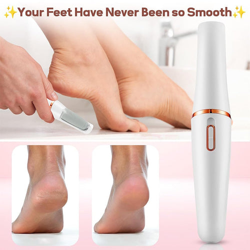 Dual Head Electric Feet Callus Remover