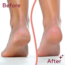 Load image into Gallery viewer, Dual Head Electric Feet Callus Remover